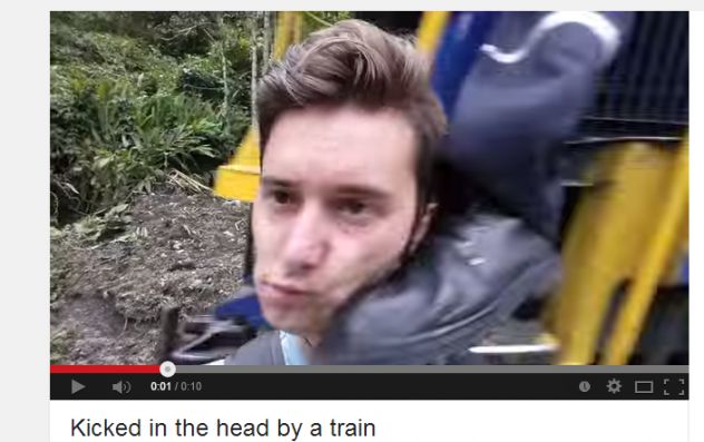 And he said, the train hit him in the head .....